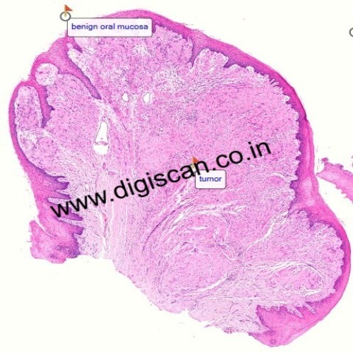 MDS Oral Pathology Exam Cases (Digital Slides & Spot Diagnosis)